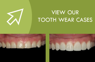 tooth wear cases